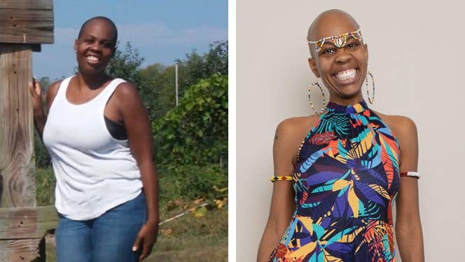 Evon Dennis shown before and after adopting a whole-food, plant-based diet and conquering her addiction to processed foods Evon Dennis shown before and after adopting a whole-food, plant-based diet and conquering her addiction to processed foods