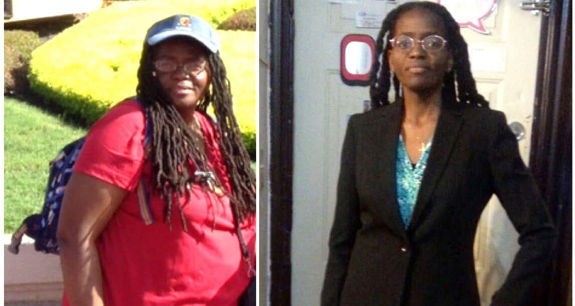 Nalida Besson before after