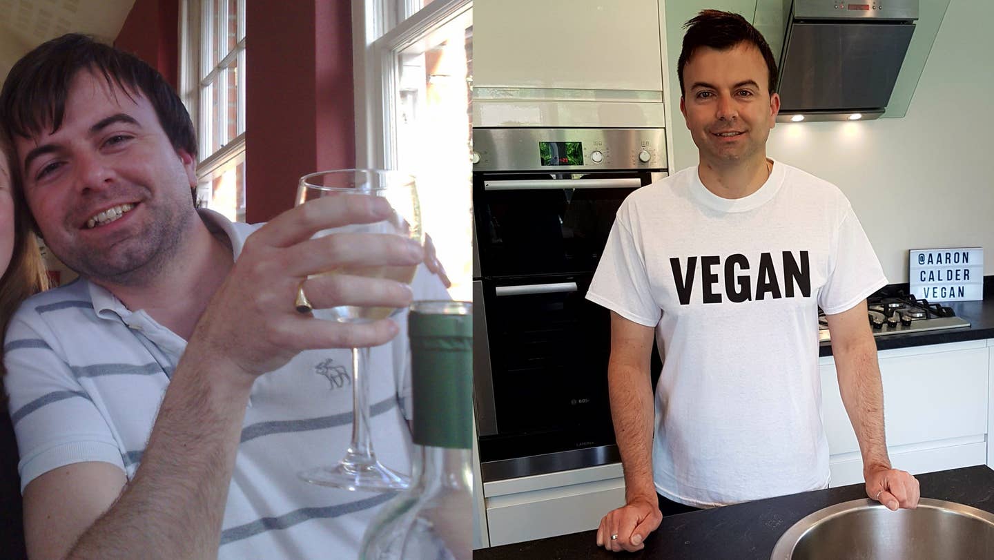 aaron calder before after cirrhosis liver disease aaron calder before after cirrhosis liver disease