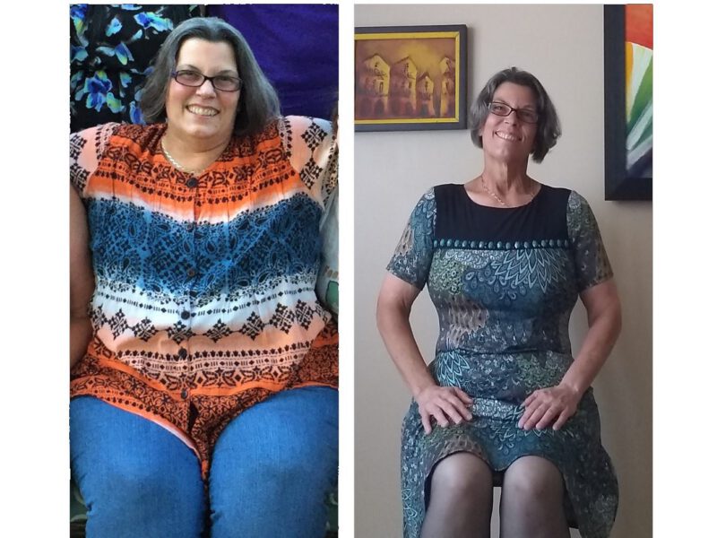 Sandra Krebs Glaucoma Diet Weight Loss
