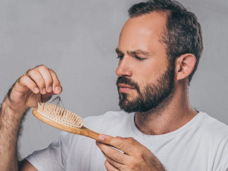Hair loss diet