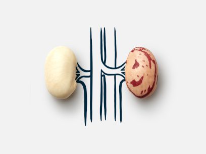 Two kidney beans are connected by an illustration of veins to signify kidney disease