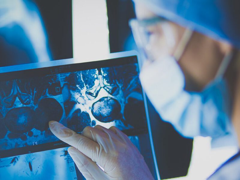 A masked doctor looks at a MRI scan