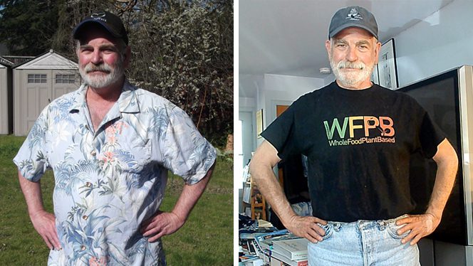 Douglas Gordy before and after adopting a plant-based diet for weight loss, rosacea, and high cholesterol