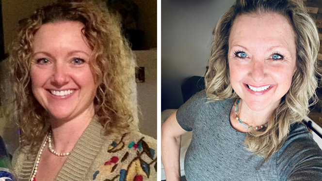 Jo Pronger Faulkner Before and After Adopting a Plant-Based Oil-Free Vegan Diet to Manage Autoimmune Symptoms -- in the "After" photo, her skin looks healthier and less puffy