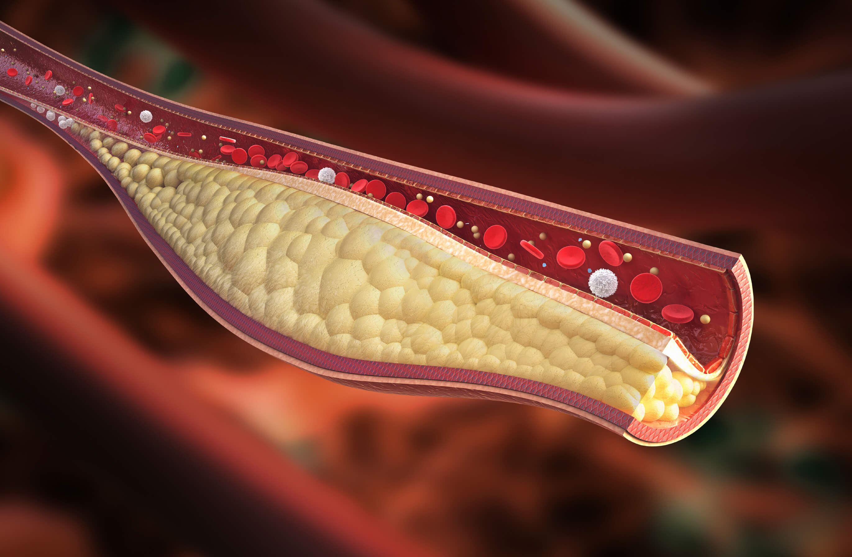 Chicken Cholesterol Chart