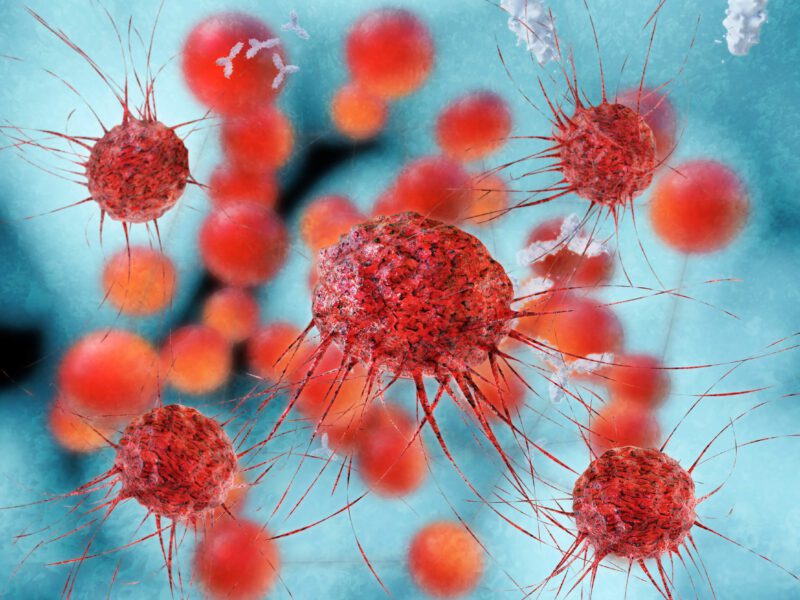 image of cancer cells