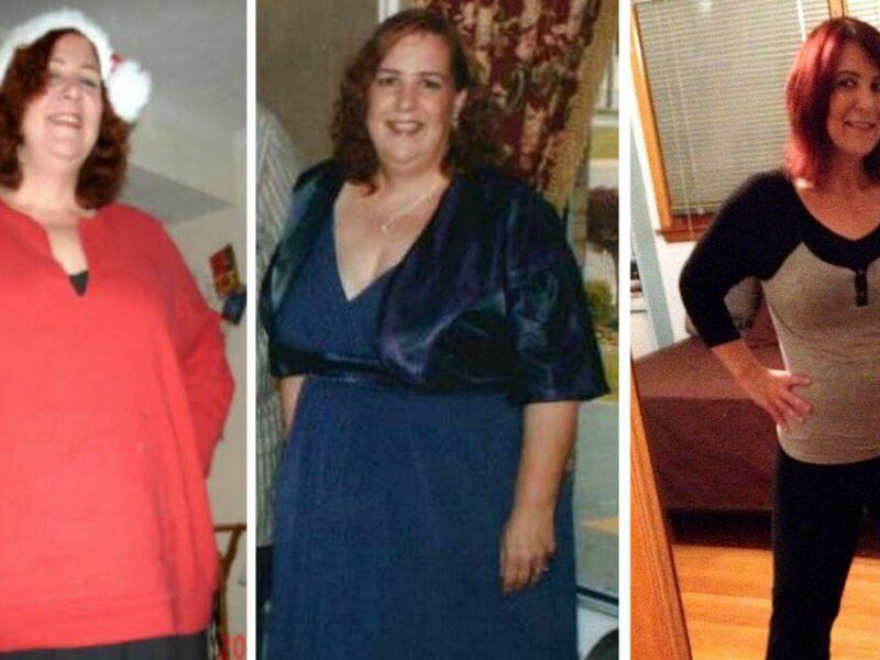 Karen Hauserman before after
