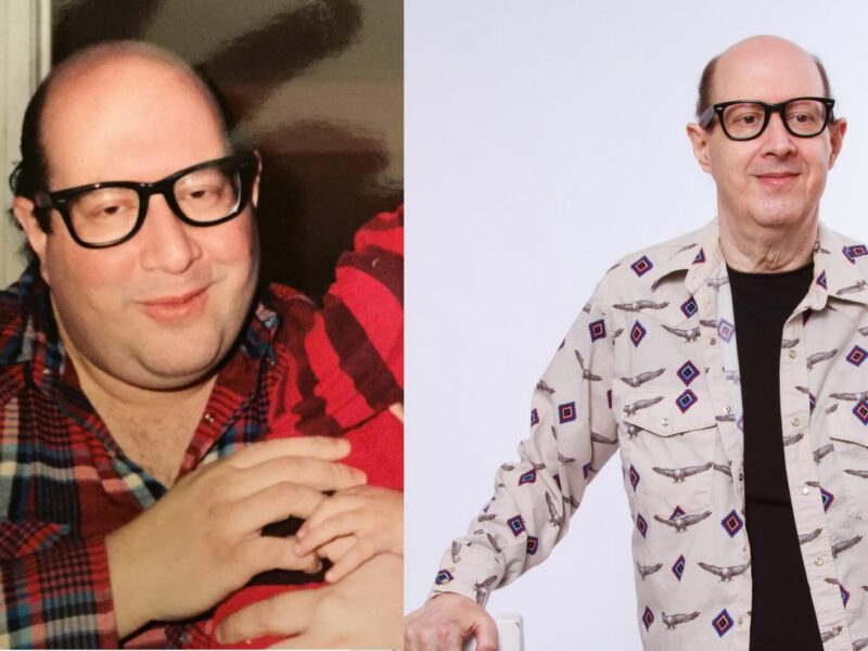 Mike Meltzer before after