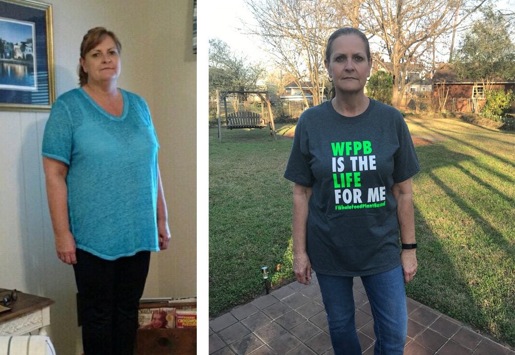 Dawn Clark Heart Disease Plant-Based Diet Before After