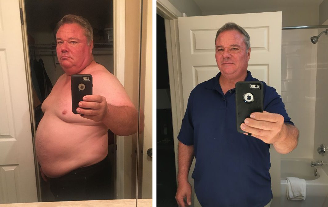 Cirrhosis on a plant-based diet - before and after