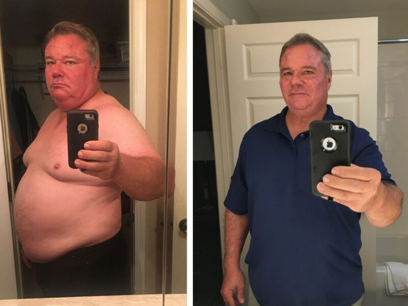 Cirrhosis on a plant-based diet - before and after
